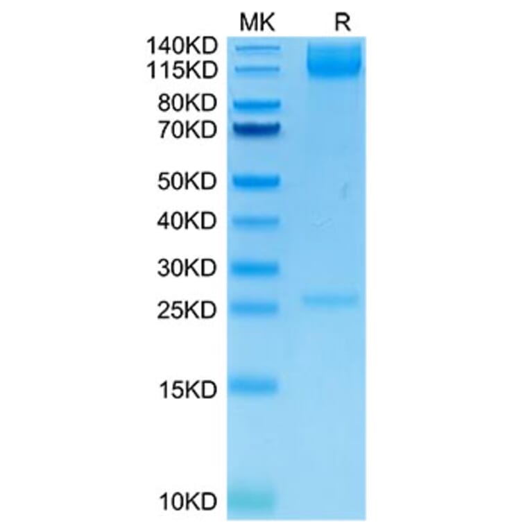 Tris-Bis PAGE - Recombinant Human Integrin alpha 5 + Integrin beta 1 Protein (C-terminal His and Avi Tag) (A330943) - Antibodies.com