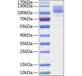 SDS-PAGE - Recombinant Human Integrin beta 1 Protein (C-terminal His Tag) (A330944) - Antibodies.com