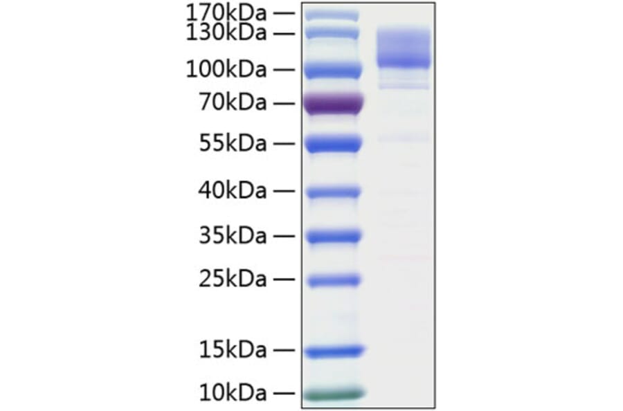 SDS-PAGE - Recombinant Human Integrin beta 1 Protein (C-terminal His Tag) (A330944) - Antibodies.com