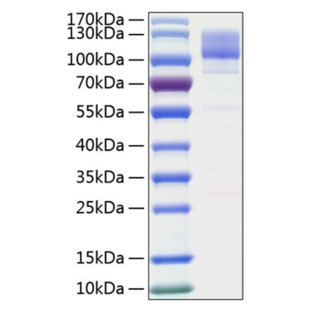 SDS-PAGE - Recombinant Human Integrin beta 1 Protein (C-terminal His Tag) (A330944) - Antibodies.com