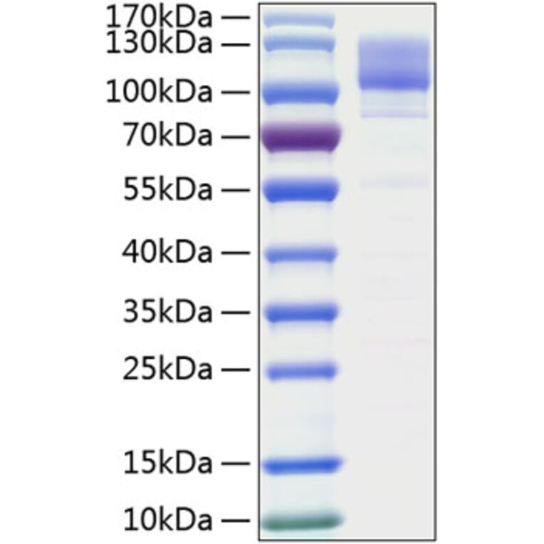 SDS-PAGE - Recombinant Human Integrin beta 1 Protein (C-terminal His Tag) (A330944) - Antibodies.com