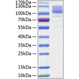 SDS-PAGE - Recombinant Human Integrin beta 1 Protein (C-terminal His Tag) (A330944) - Antibodies.com