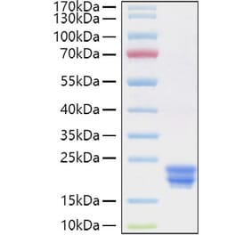 SDS-PAGE - Recombinant Human Interferon alpha 2 Protein (C-terminal His Tag) (A330945) - Antibodies.com