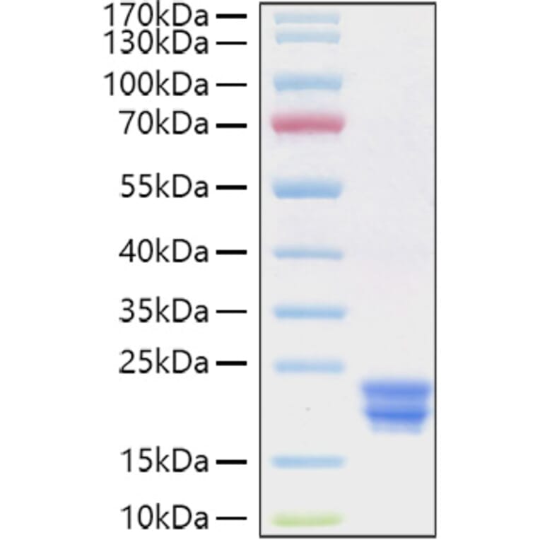 SDS-PAGE - Recombinant Human Interferon alpha 2 Protein (C-terminal His Tag) (A330945) - Antibodies.com