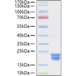 SDS-PAGE - Recombinant Human Interferon alpha 2 Protein (C-terminal His Tag) (A330945) - Antibodies.com