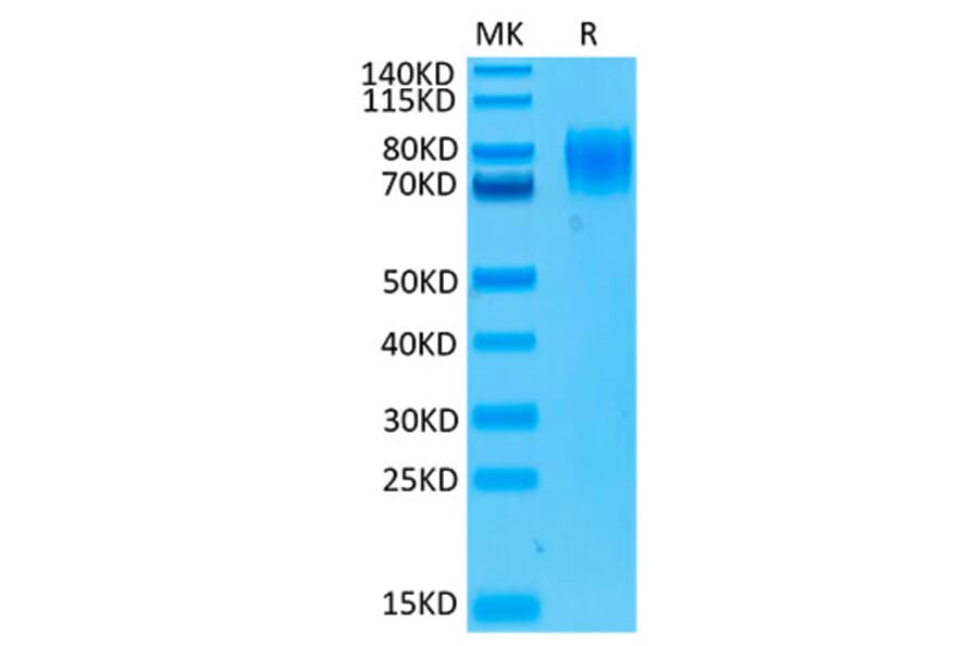 Tris-Bis PAGE - Recombinant Human Interferon alpha/beta Receptor 1 Protein (Biotin) (C-terminal His and Avi Tag) (A330946) - Antibodies.com