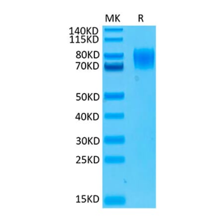 Tris-Bis PAGE - Recombinant Human Interferon alpha/beta Receptor 1 Protein (Biotin) (C-terminal His and Avi Tag) (A330946) - Antibodies.com