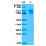 Tris-Bis PAGE - Recombinant Human Interferon alpha/beta Receptor 1 Protein (Biotin) (C-terminal His and Avi Tag) (A330946) - Antibodies.com