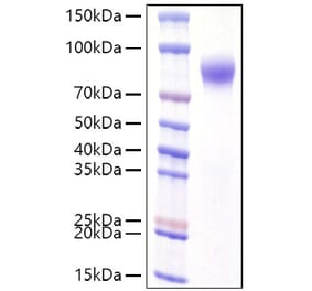 SDS-PAGE - Recombinant Human Interferon alpha/beta Receptor 1 Protein (C-terminal His Tag) (A330947) - Antibodies.com