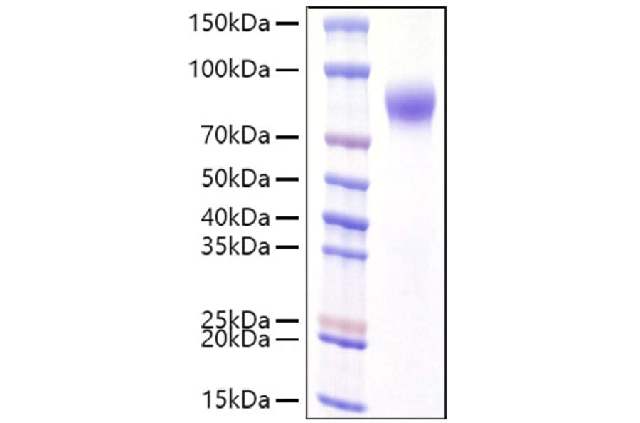 SDS-PAGE - Recombinant Human Interferon alpha/beta Receptor 1 Protein (C-terminal His Tag) (A330947) - Antibodies.com