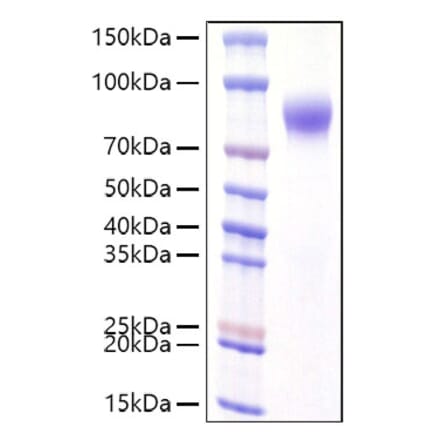 SDS-PAGE - Recombinant Human Interferon alpha/beta Receptor 1 Protein (C-terminal His Tag) (A330947) - Antibodies.com
