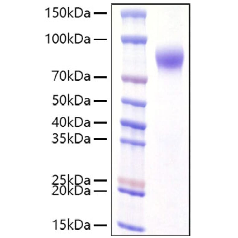 SDS-PAGE - Recombinant Human Interferon alpha/beta Receptor 1 Protein (C-terminal His Tag) (A330947) - Antibodies.com