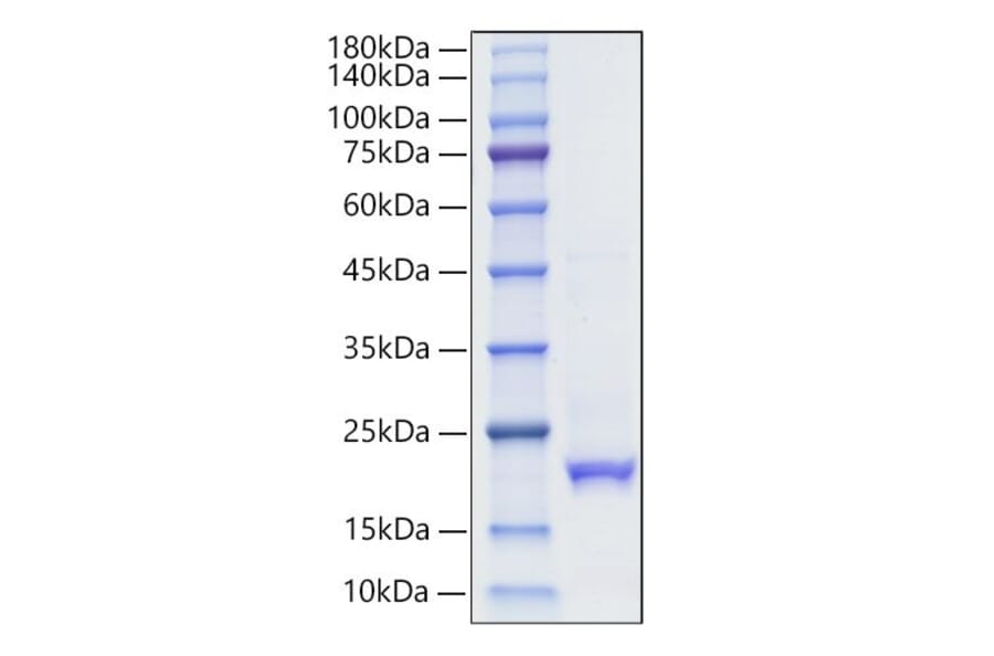 SDS-PAGE - Recombinant Human Interferon alpha10 Protein (C-terminal His Tag) (A330948) - Antibodies.com