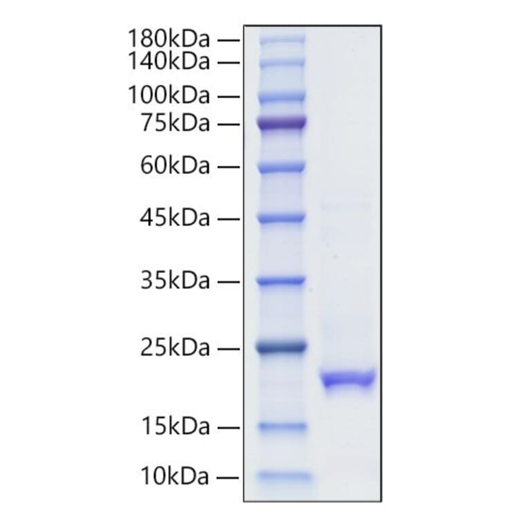 SDS-PAGE - Recombinant Human Interferon alpha10 Protein (C-terminal His Tag) (A330948) - Antibodies.com