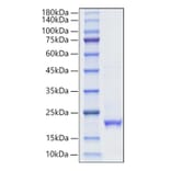 SDS-PAGE - Recombinant Human Interferon alpha10 Protein (C-terminal His Tag) (A330948) - Antibodies.com