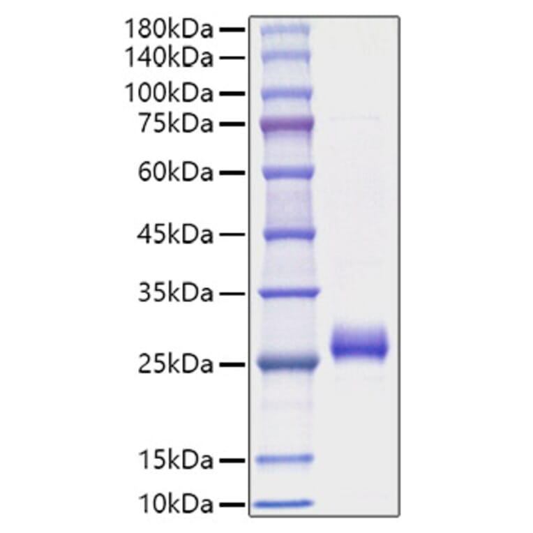 SDS-PAGE - Recombinant Human Interferon omega Protein (C-terminal His Tag) (A330949) - Antibodies.com