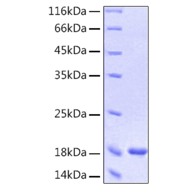 SDS-PAGE - Recombinant Human Interferon-alpha Protein (C-terminal His Tag) (A330950) - Antibodies.com