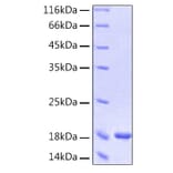 SDS-PAGE - Recombinant Human Interferon-alpha Protein (C-terminal His Tag) (A330950) - Antibodies.com