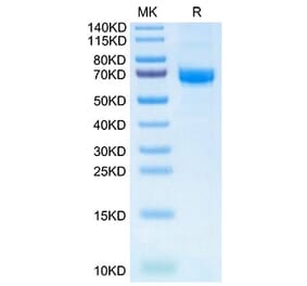 Tris-Bis PAGE - Recombinant Human Intestinal Alkaline Phosphatase Protein (N-terminal His and Flag Tag) (A330951) - Antibodies.com