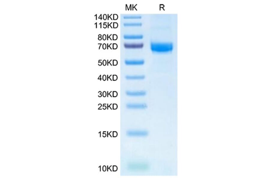 Tris-Bis PAGE - Recombinant Human Intestinal Alkaline Phosphatase Protein (N-terminal His and Flag Tag) (A330951) - Antibodies.com