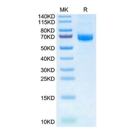 Tris-Bis PAGE - Recombinant Human Intestinal Alkaline Phosphatase Protein (N-terminal His and Flag Tag) (A330951) - Antibodies.com