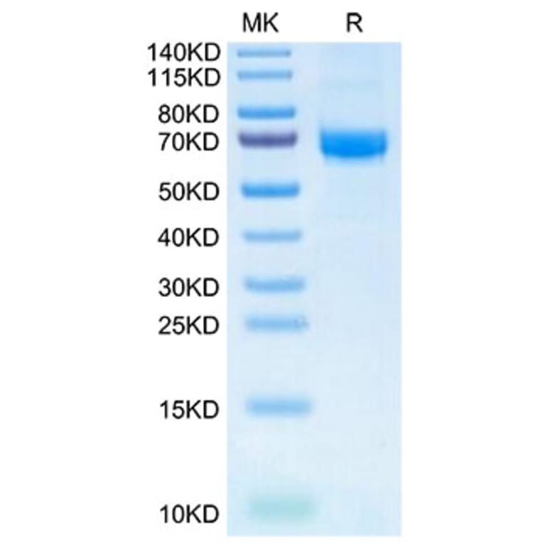 Tris-Bis PAGE - Recombinant Human Intestinal Alkaline Phosphatase Protein (N-terminal His and Flag Tag) (A330951) - Antibodies.com