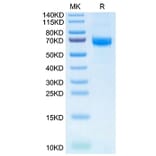 Tris-Bis PAGE - Recombinant Human Intestinal Alkaline Phosphatase Protein (N-terminal His and Flag Tag) (A330951) - Antibodies.com