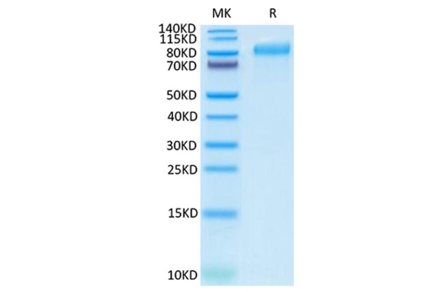 SDS-PAGE - Recombinant Human ITGB6 Protein (C-terminal His Tag) (A330953) - Antibodies.com