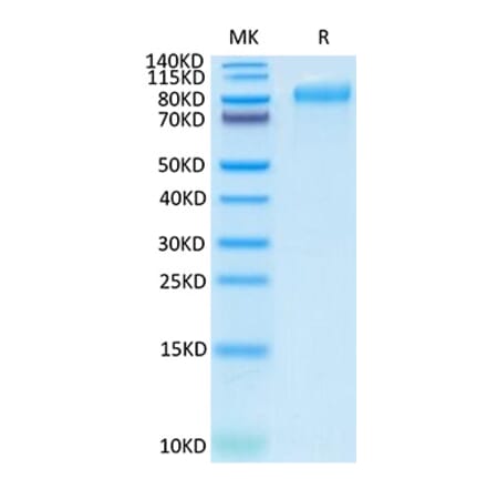SDS-PAGE - Recombinant Human ITGB6 Protein (C-terminal His Tag) (A330953) - Antibodies.com