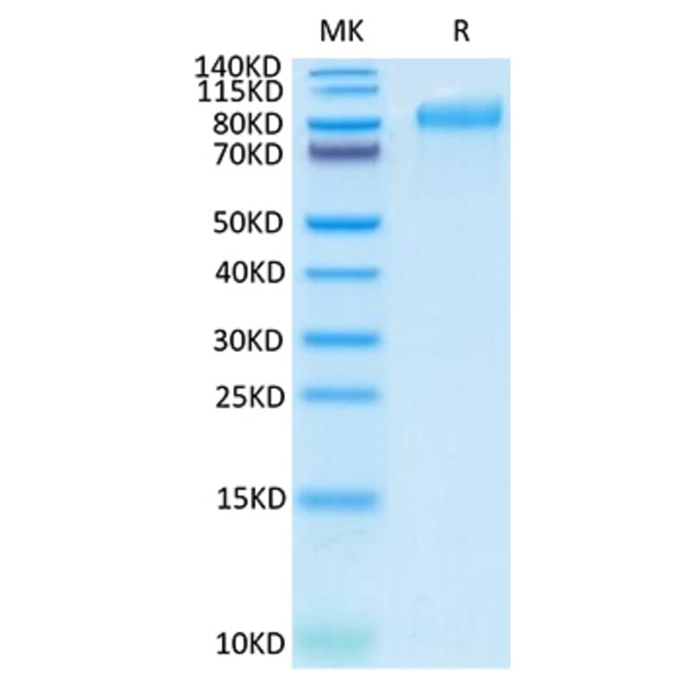 SDS-PAGE - Recombinant Human ITGB6 Protein (C-terminal His Tag) (A330953) - Antibodies.com