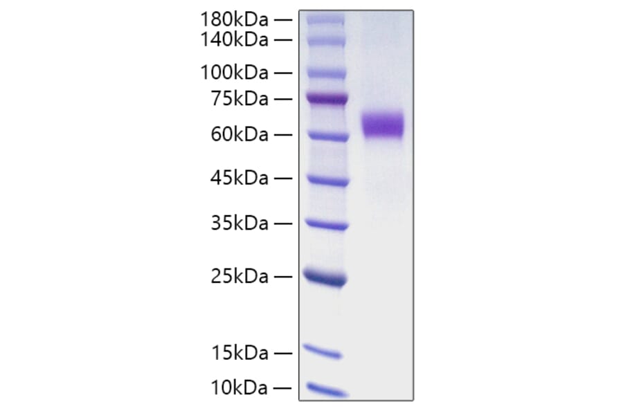 SDS-PAGE - Recombinant Human Jagged1 Protein (C-terminal Human Fc Tag) (A330954) - Antibodies.com