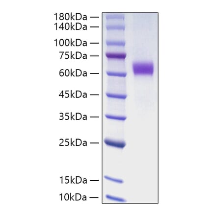 SDS-PAGE - Recombinant Human Jagged1 Protein (C-terminal Human Fc Tag) (A330954) - Antibodies.com