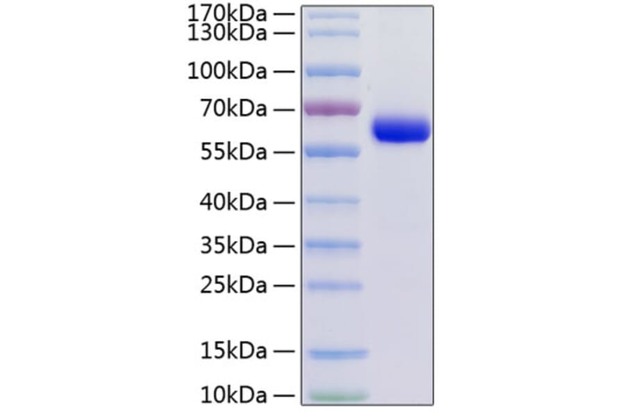 SDS-PAGE - Recombinant Human JAM-C Protein (C-terminal Human Fc and His Tag) (A330955) - Antibodies.com