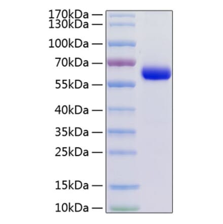 SDS-PAGE - Recombinant Human JAM-C Protein (C-terminal Human Fc and His Tag) (A330955) - Antibodies.com