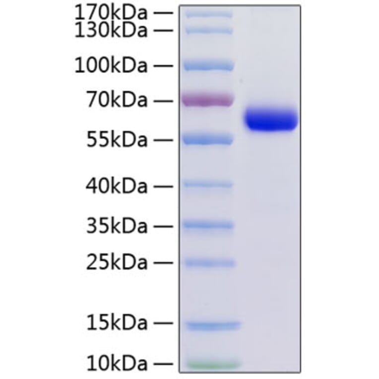 SDS-PAGE - Recombinant Human JAM-C Protein (C-terminal Human Fc and His Tag) (A330955) - Antibodies.com