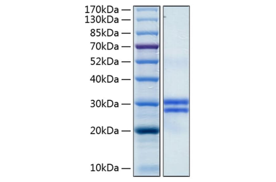 SDS-PAGE - Recombinant Human Junctional Adhesion Molecule 1/JAM-A Protein (C-terminal His Tag) (A330956) - Antibodies.com