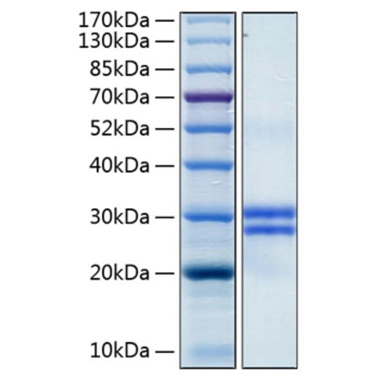 SDS-PAGE - Recombinant Human Junctional Adhesion Molecule 1/JAM-A Protein (C-terminal His Tag) (A330956) - Antibodies.com