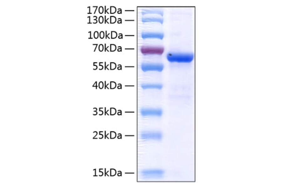 SDS-PAGE - Recombinant Human Junctional Adhesion Molecule 1/JAM-A Protein (C-terminal Human Fc and His Tag) (A330957) - Antibodies.com