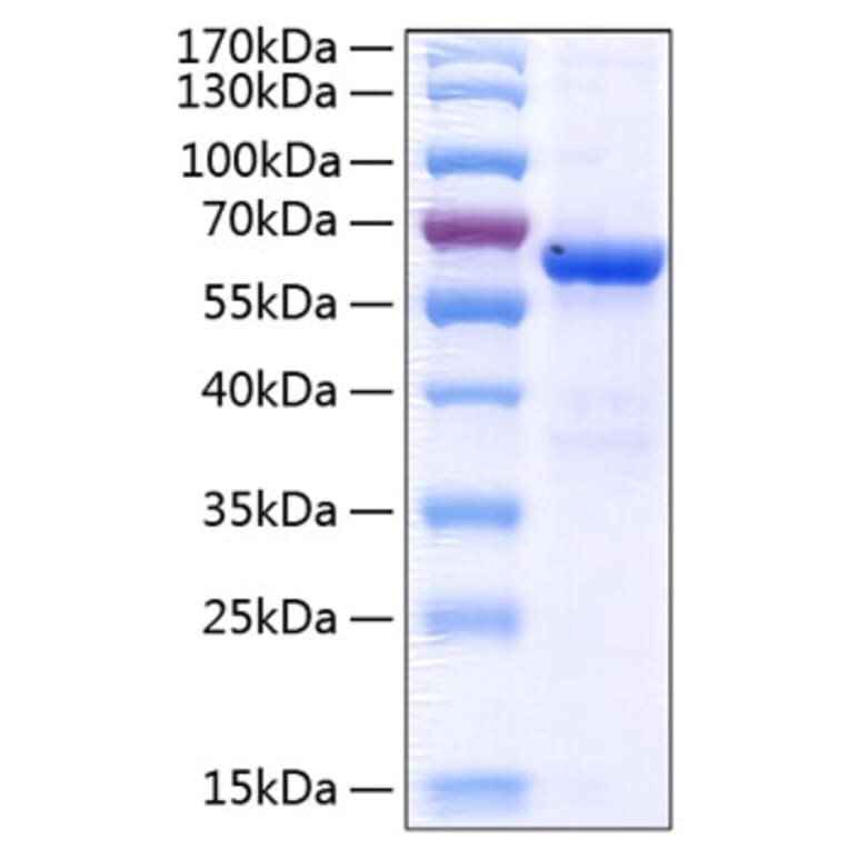 SDS-PAGE - Recombinant Human Junctional Adhesion Molecule 1/JAM-A Protein (C-terminal Human Fc and His Tag) (A330957) - Antibodies.com