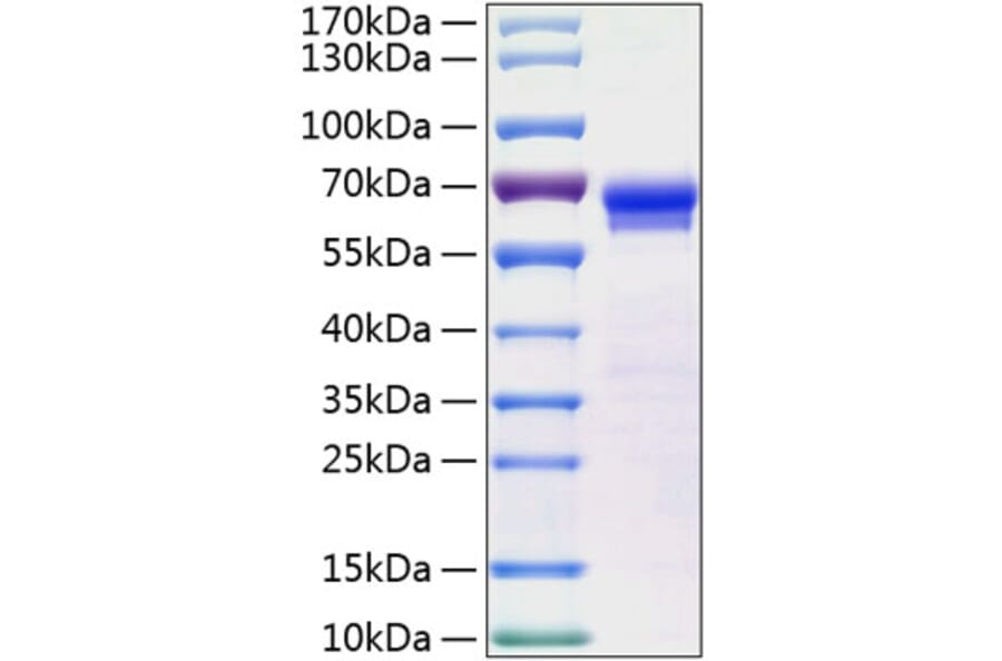 SDS-PAGE - Recombinant Human Junctional Adhesion Molecule 2/JAM-B Protein (C-terminal Human Fc and His Tag) (A330958) - Antibodies.com