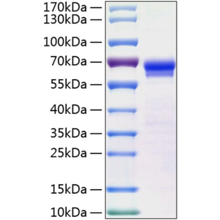 SDS-PAGE - Recombinant Human Junctional Adhesion Molecule 2/JAM-B Protein (C-terminal Human Fc and His Tag) (A330958) - Antibodies.com