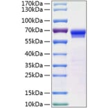 SDS-PAGE - Recombinant Human Junctional Adhesion Molecule 2/JAM-B Protein (C-terminal Human Fc and His Tag) (A330958) - Antibodies.com