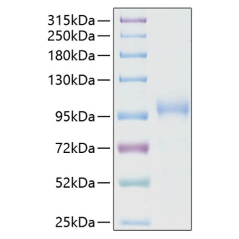 SDS-PAGE - Recombinant Human K Cadherin/CDH6 Protein (C-terminal His Tag) (A330959) - Antibodies.com