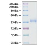 SDS-PAGE - Recombinant Human K Cadherin/CDH6 Protein (C-terminal His Tag) (A330959) - Antibodies.com