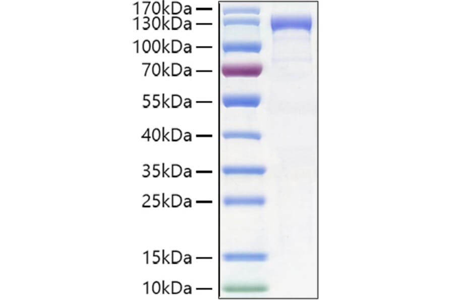 SDS-PAGE - Recombinant Human K Cadherin/CDH6 Protein (C-terminal Human Fc and His Tag) (A330960) - Antibodies.com