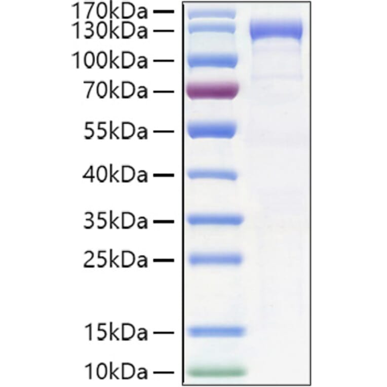 SDS-PAGE - Recombinant Human K Cadherin/CDH6 Protein (C-terminal Human Fc and His Tag) (A330960) - Antibodies.com