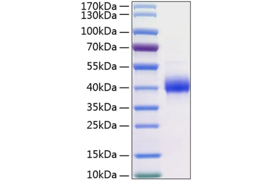 SDS-PAGE - Recombinant Human Kallikrein 11 Protein (C-terminal His Tag) (A330961) - Antibodies.com