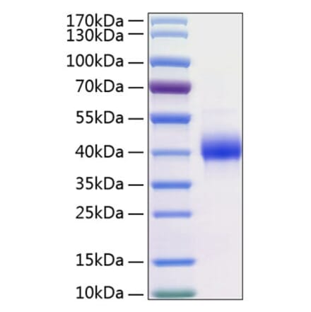SDS-PAGE - Recombinant Human Kallikrein 11 Protein (C-terminal His Tag) (A330961) - Antibodies.com