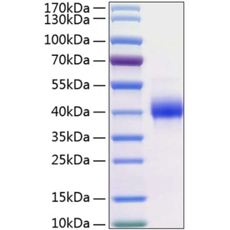 SDS-PAGE - Recombinant Human Kallikrein 11 Protein (C-terminal His Tag) (A330961) - Antibodies.com