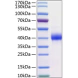 SDS-PAGE - Recombinant Human Kallikrein 11 Protein (C-terminal His Tag) (A330961) - Antibodies.com